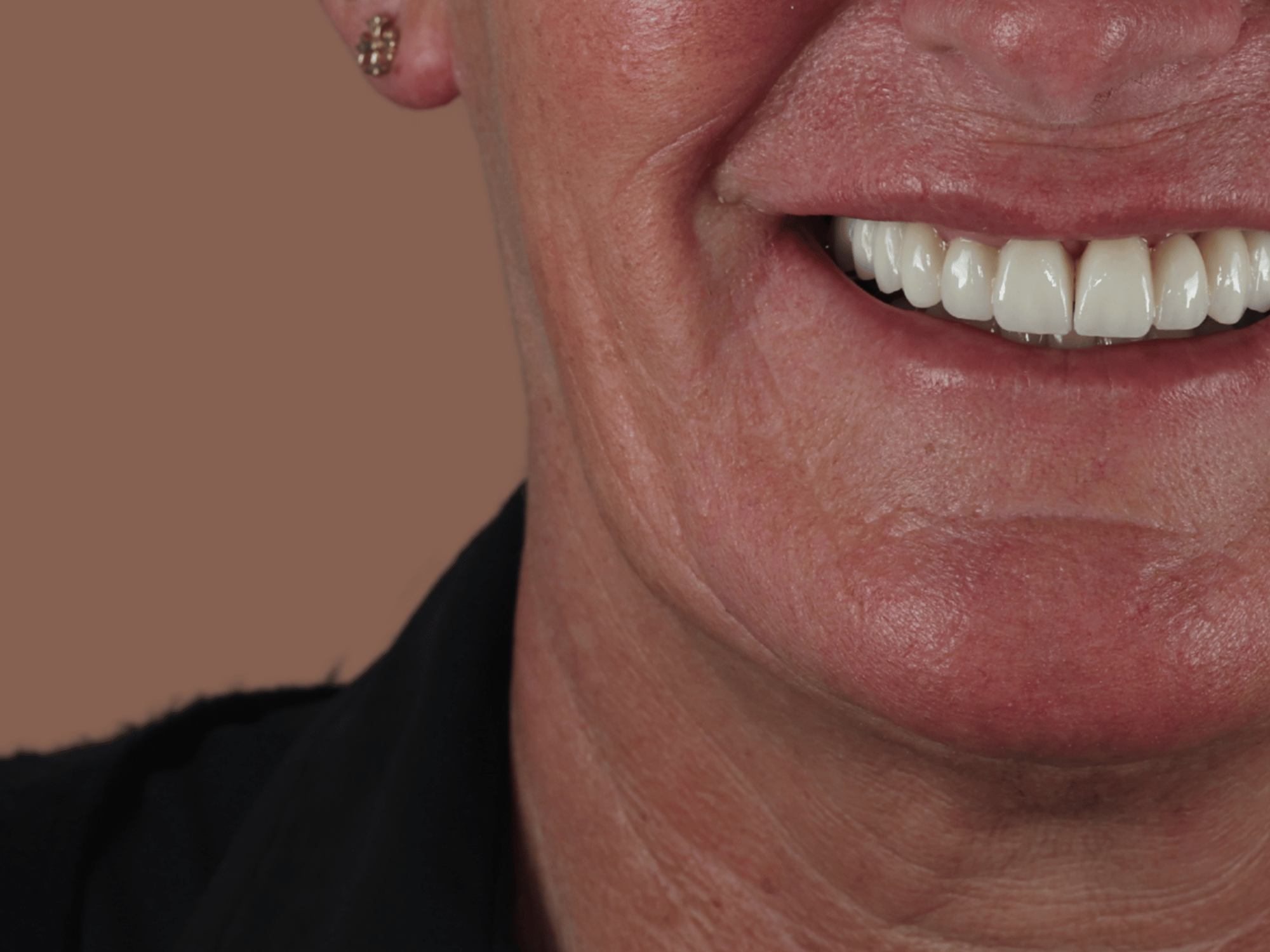 Natural Smiles (6)