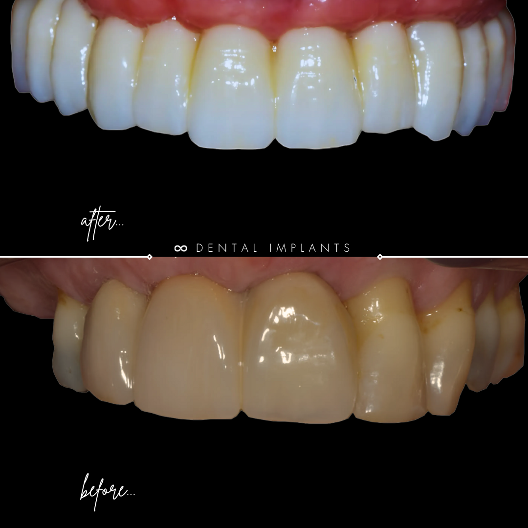 TEETH TRANSFORMATIONS - 2025-02-12T094826.705 TEETH TRANSFORMATIONS - 2025-02-12T094826.705