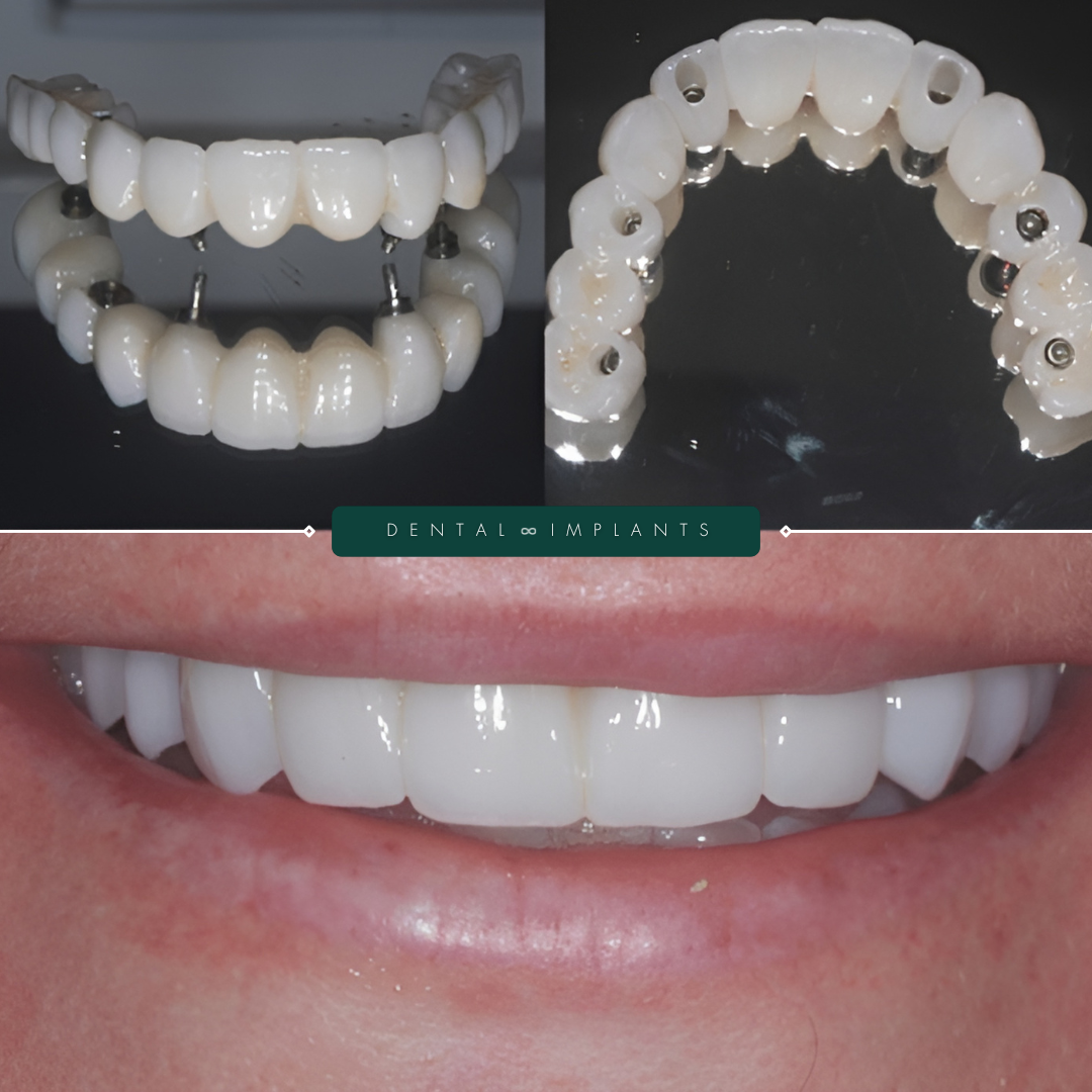 TEETH TRANSFORMATIONS - 2025-02-24T181729.286 TEETH TRANSFORMATIONS - 2025-02-24T181729.286