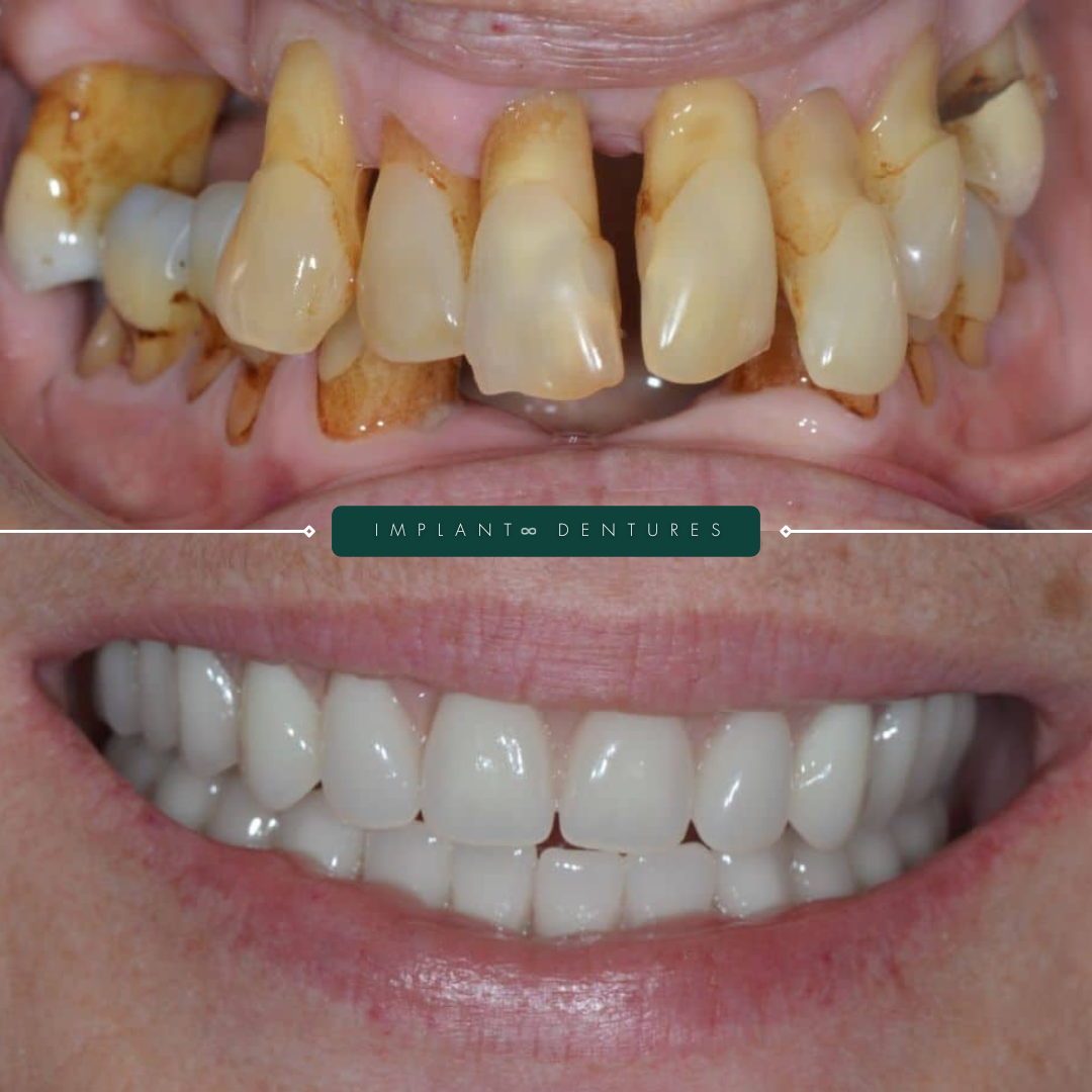 TEETH TRANSFORMATIONS - 2025-02-24T192429.425 TEETH TRANSFORMATIONS - 2025-02-24T192429.425