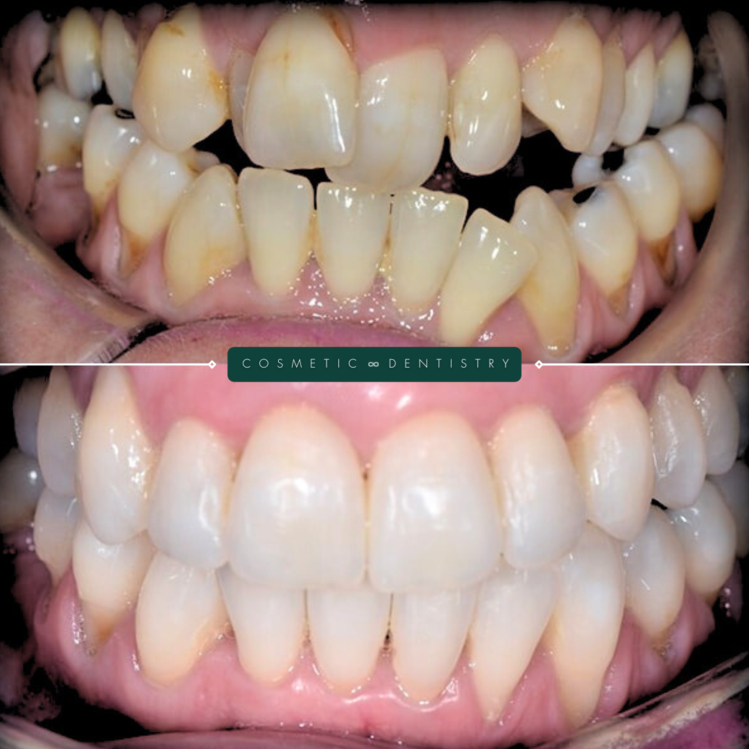 TEETH TRANSFORMATIONS - 2025-02-25T094647.092 TEETH TRANSFORMATIONS - 2025-02-25T094647.092