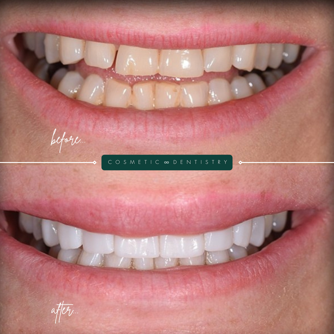 TEETH TRANSFORMATIONS - 2025-02-25T110739.360 TEETH TRANSFORMATIONS - 2025-02-25T110739.360