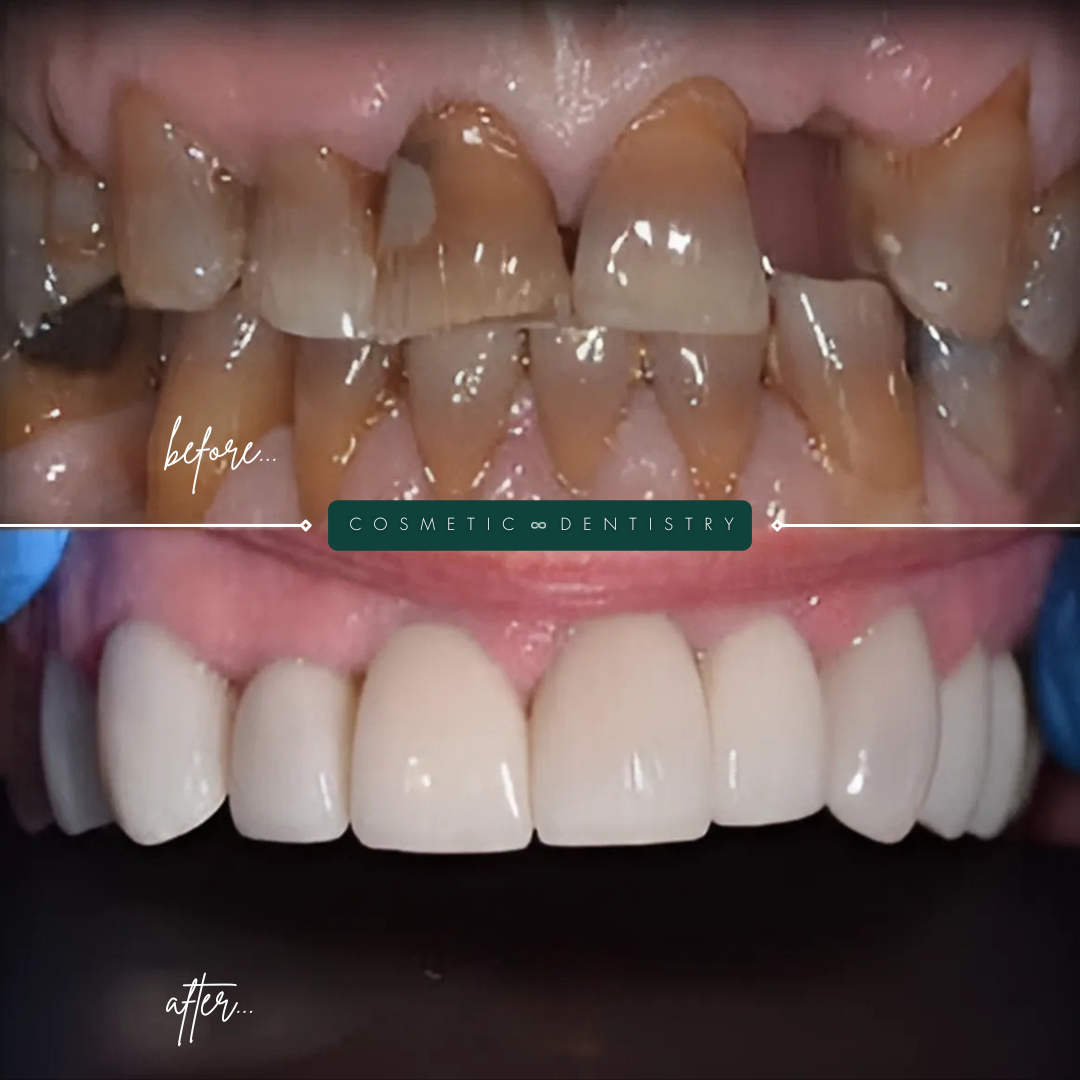TEETH TRANSFORMATIONS - 2025-02-25T114356.019 TEETH TRANSFORMATIONS - 2025-02-25T114356.019